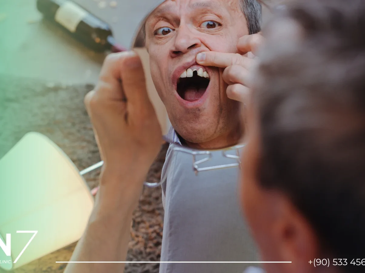ön diş kaybı