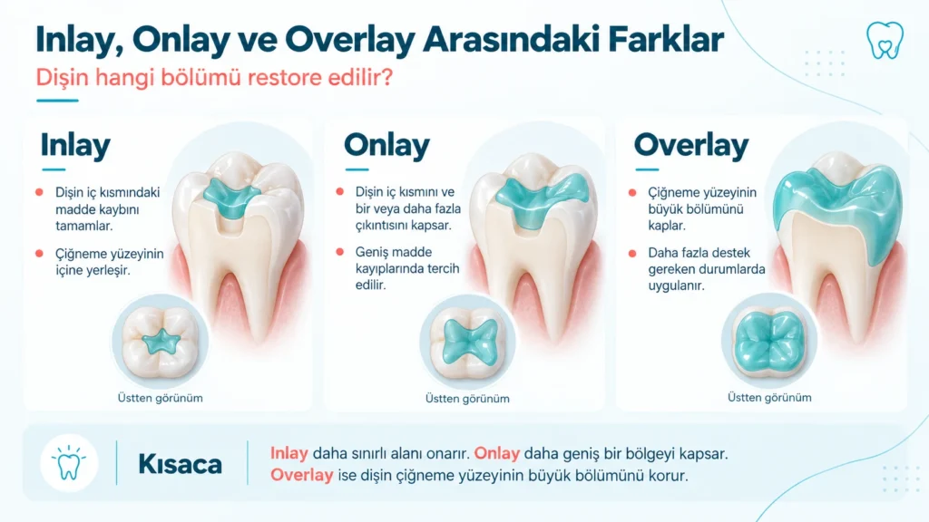 inlay onlay ve overlay dolgu