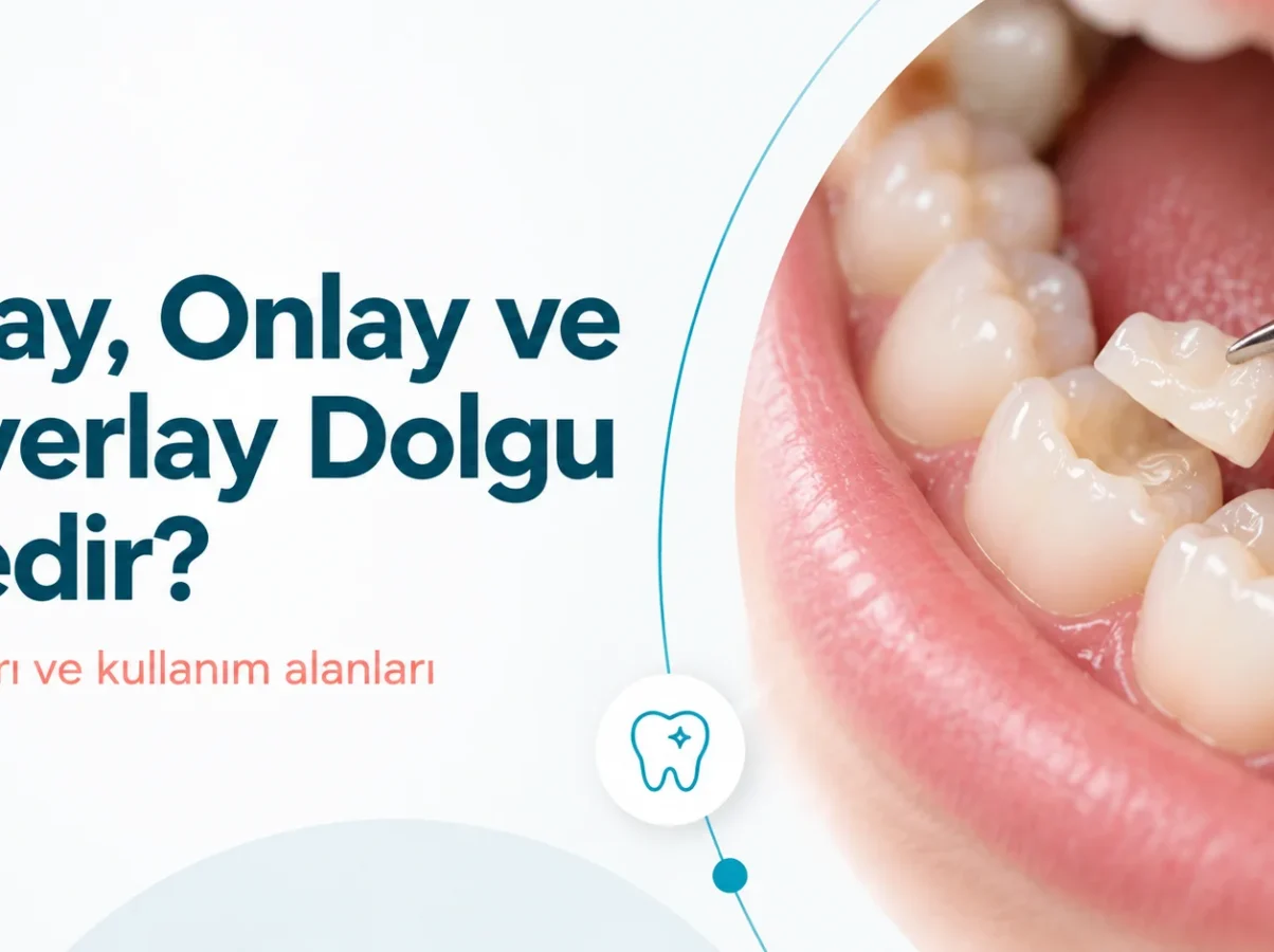 inlay-onlay-ve-overlay-dolgu-nedir