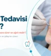 kanal-tedavisi-nedir